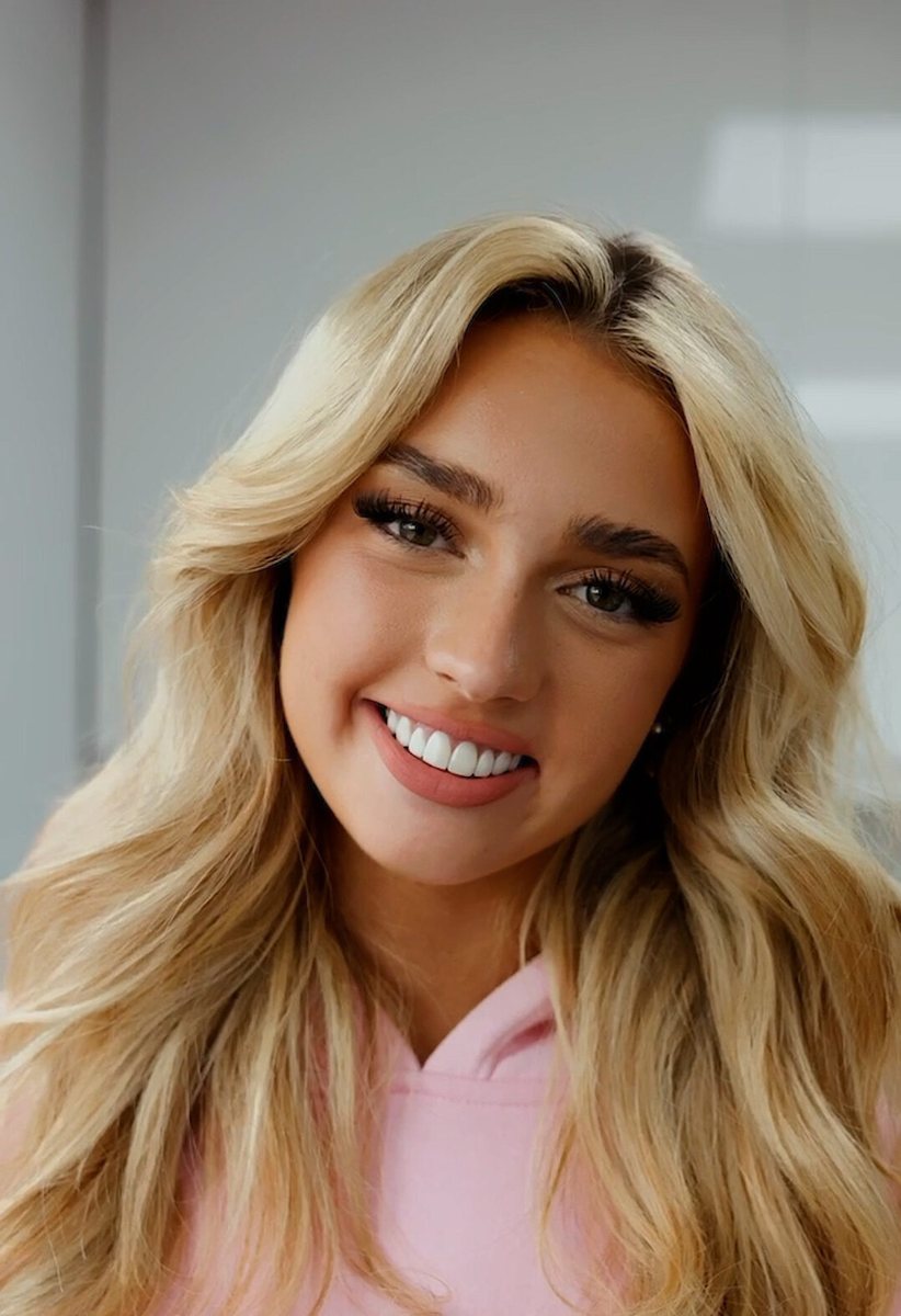 Isabella – Composite bonding, Ark Dentistry patient